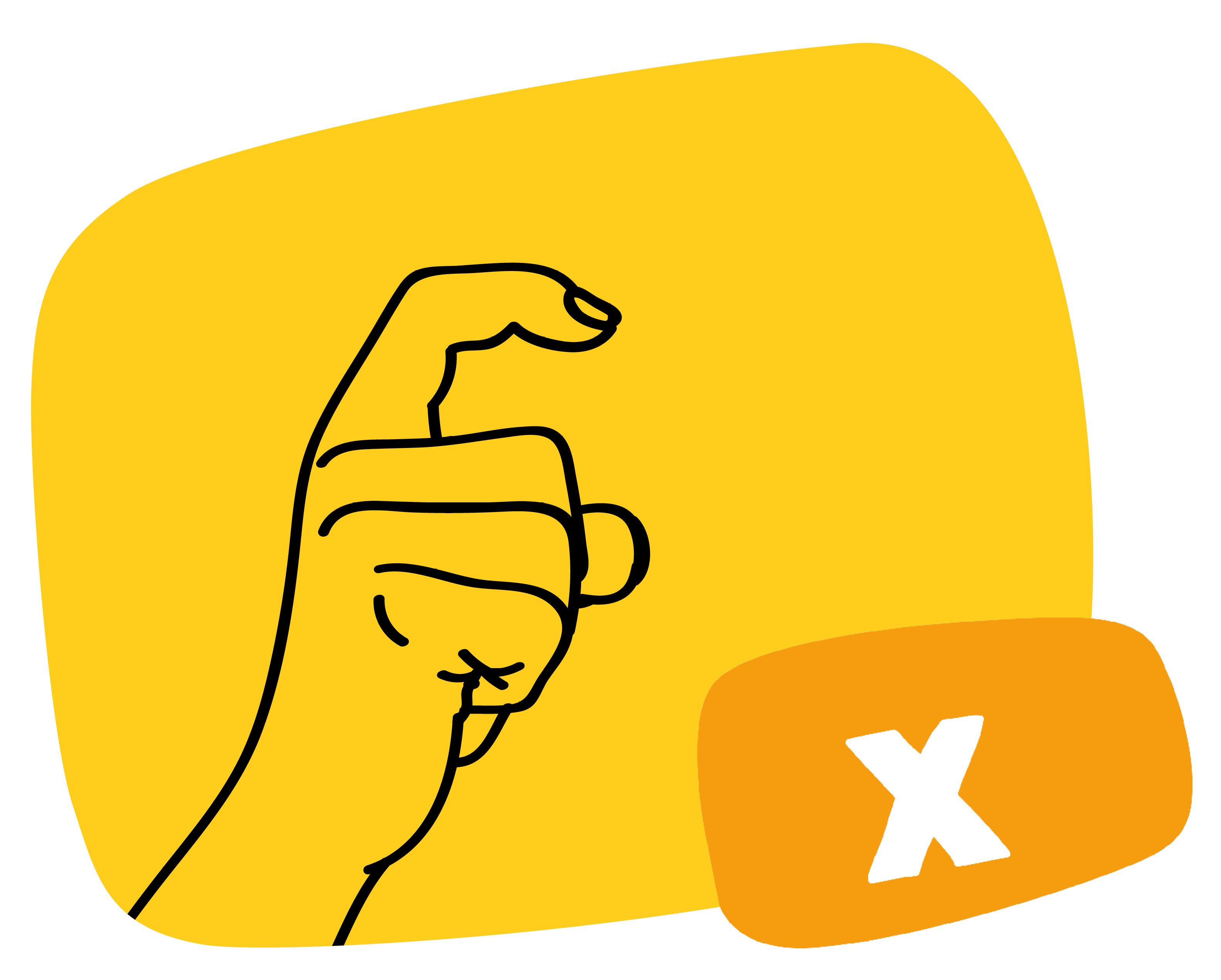 X